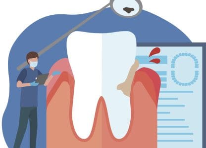 Santé bucco-dentaire : un tiers de la population française concernée par des parodontites sévères